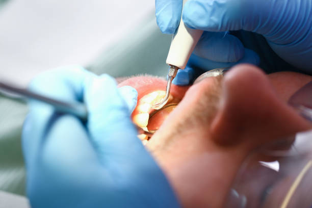 Best Cosmetic Emergency Dentistry in Park Ridge, IL
