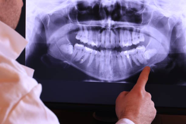 Best Emergency Denture Repair in Park Ridge, IL