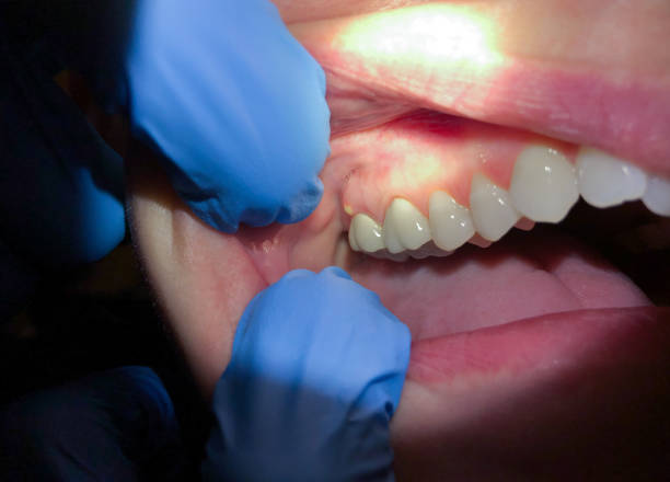 Best Urgent Care for Lost Fillings or Crowns in Park Ridge, IL